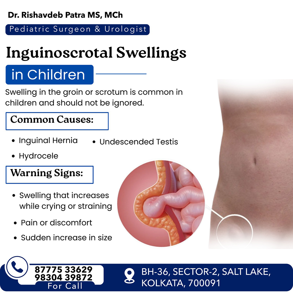 Inguinoscrotal Swelling in Children