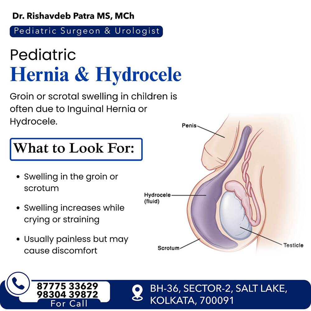 Pediatric Hernia Hydrocele Treatment